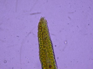 Picture of leaf tip of Didymodon rigidulus