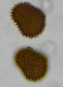Picture of Fossombronia wondraczekii spores